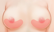 breast4_img1d
